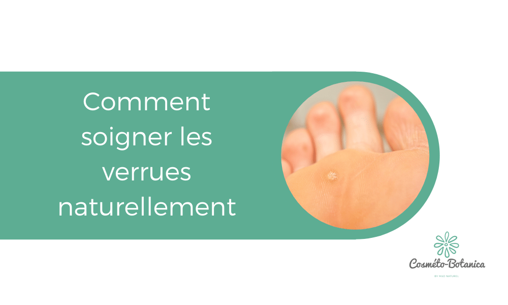 Comment soigner les verrues naturellement?