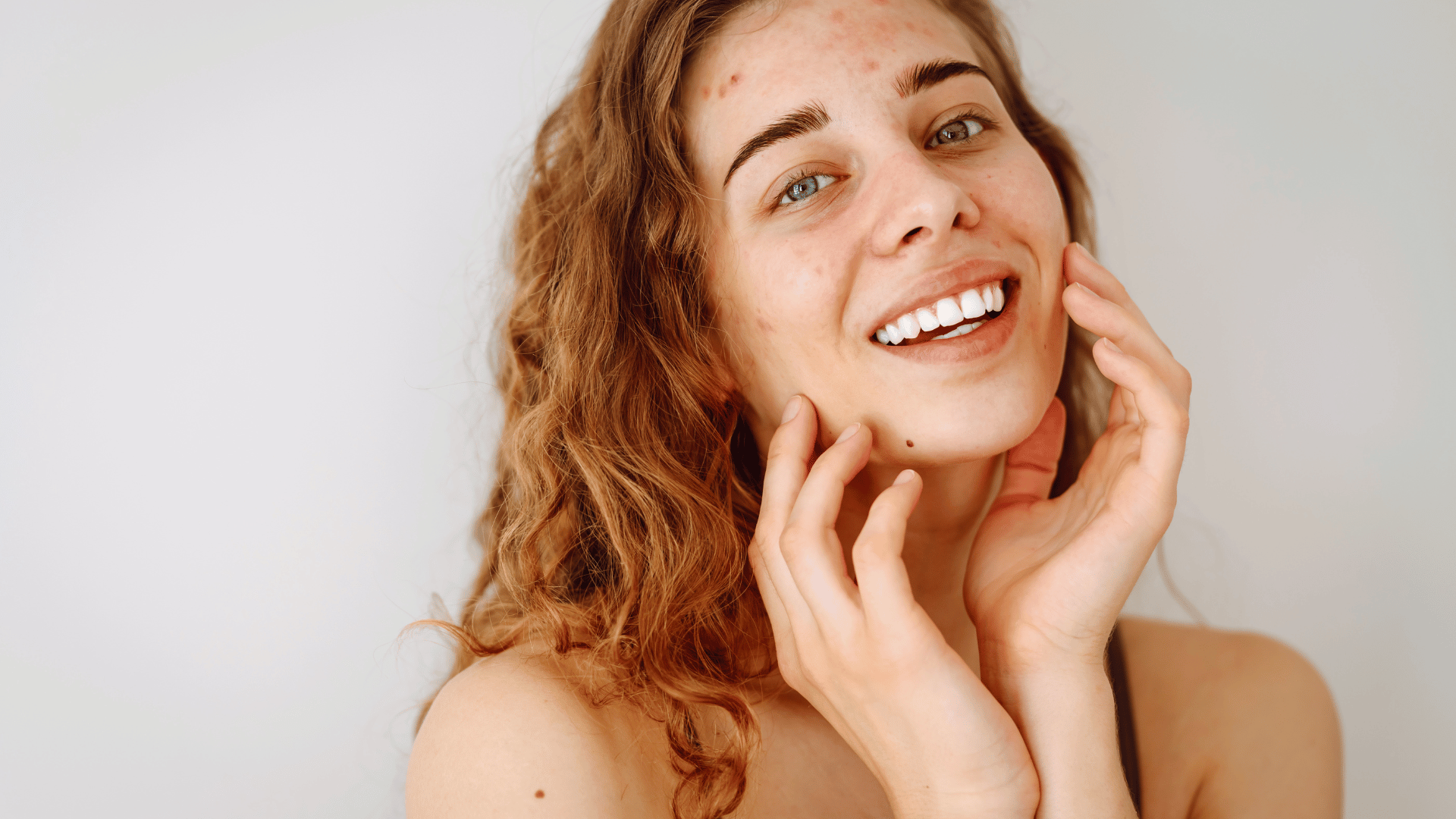 Solution contre l'acné et les mycrokystes et boutons