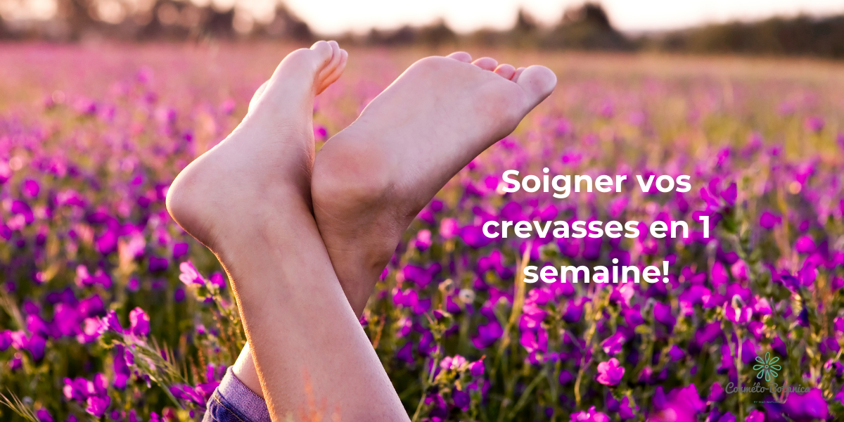 Soigner vos crevasses en 1 semaine!