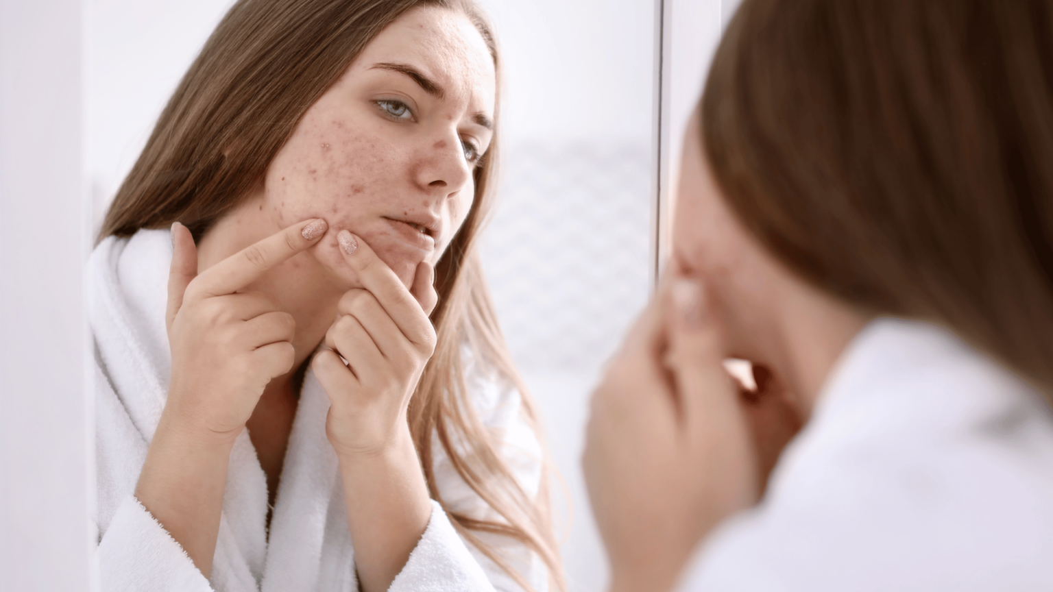 4 étapes pour soigner l’acné naturellement