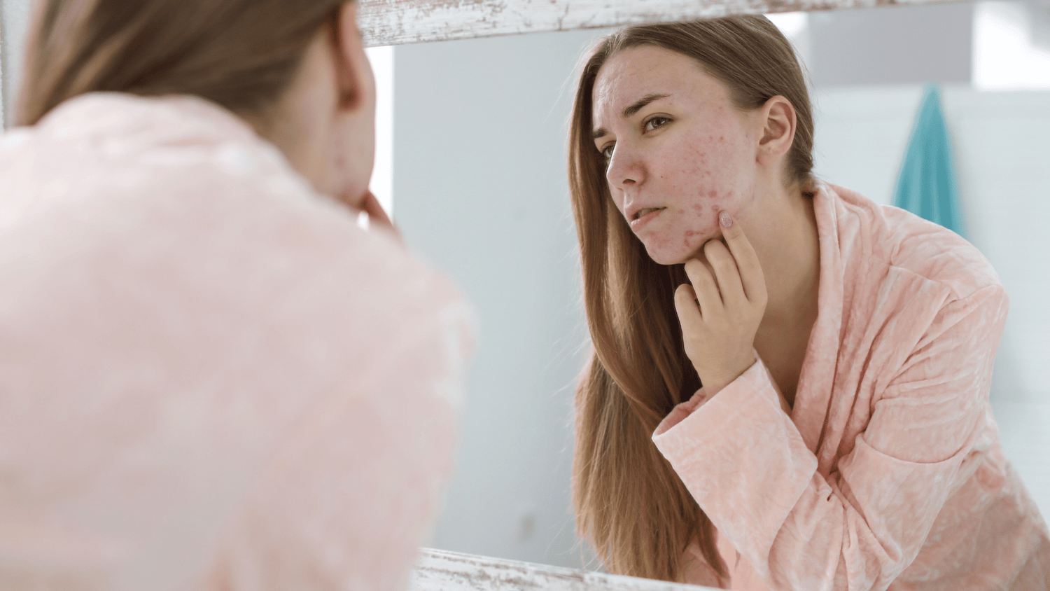 L’impact psychologique de l’acné